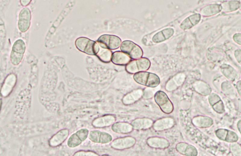 macrostoma
