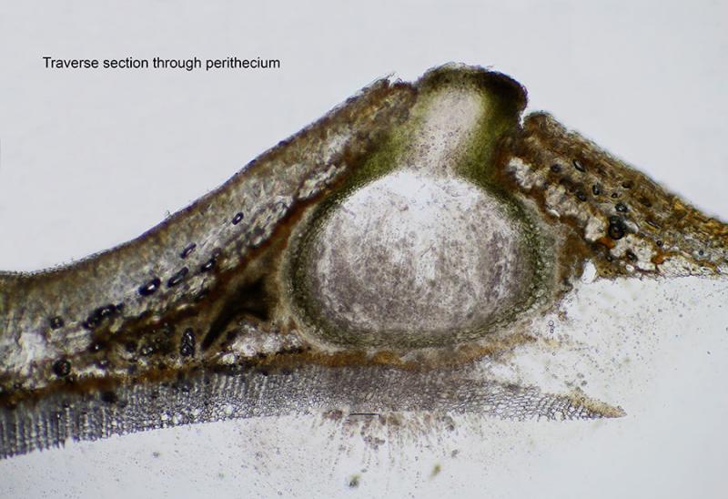 macrostoma