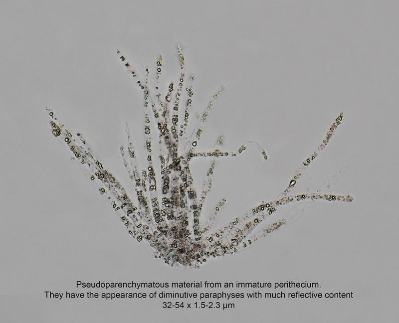 macrostoma