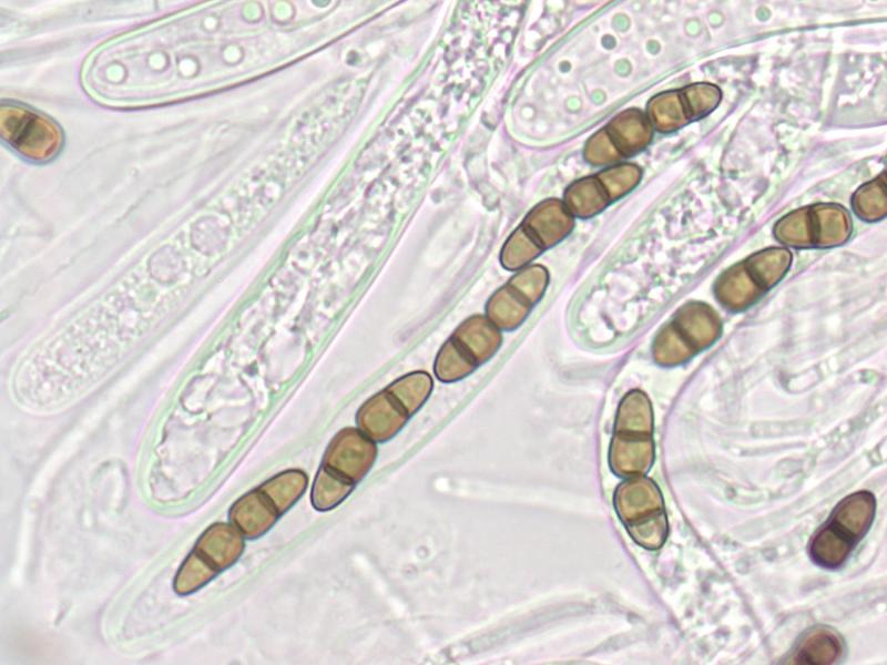 macrostoma