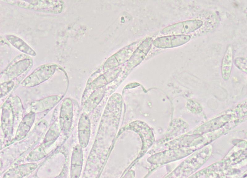 macrostoma
