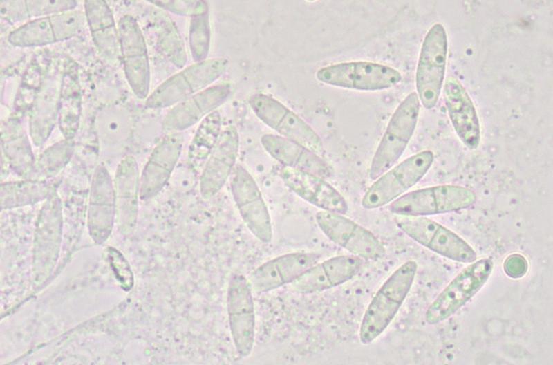 macrostoma