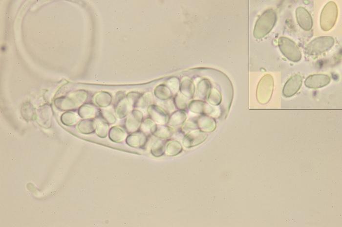 macrostoma