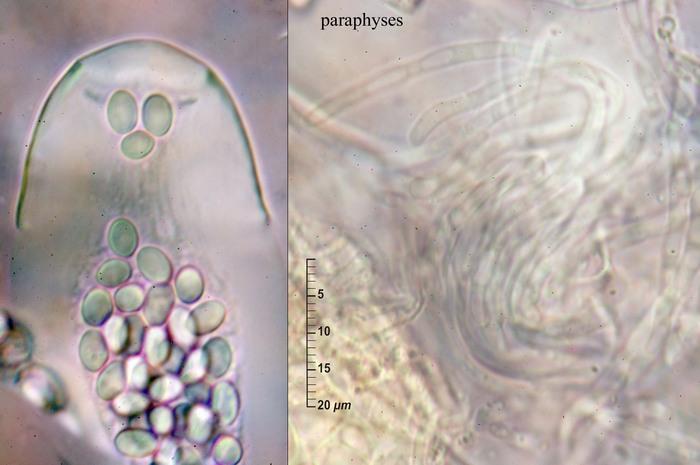 macrostoma