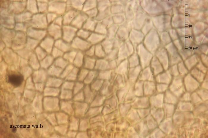 macrostoma