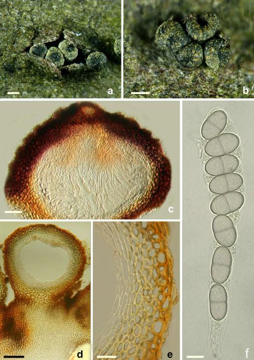 macrostoma