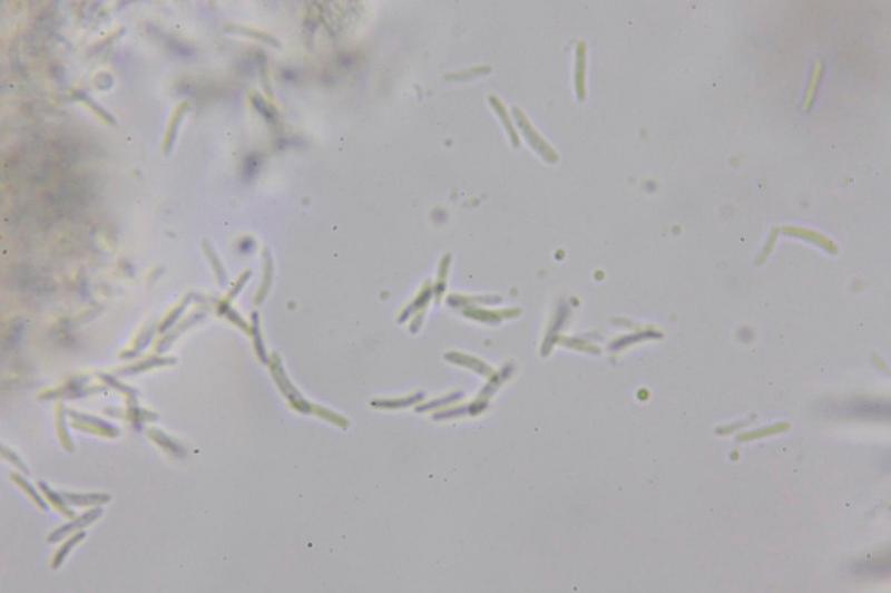 macrostoma