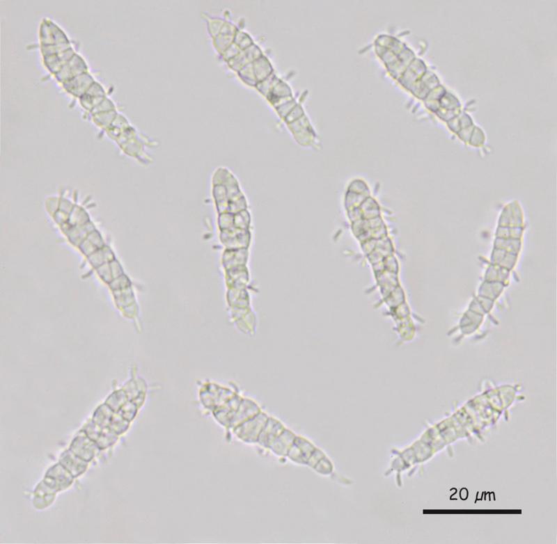 macrostoma