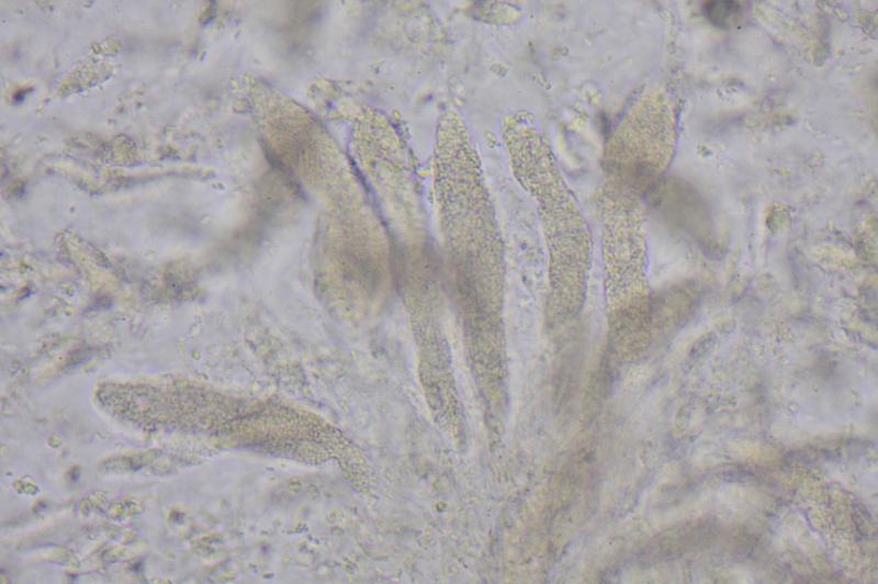 macrostoma