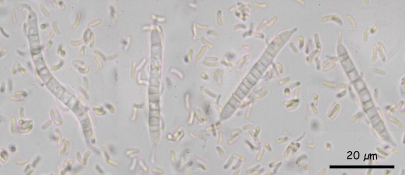 macrostoma