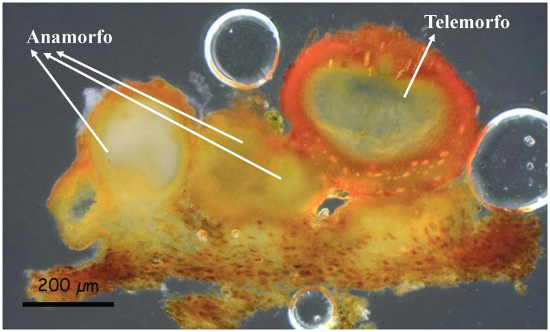 macrostoma