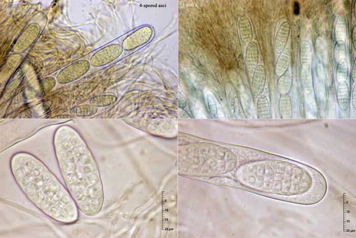 macrostoma