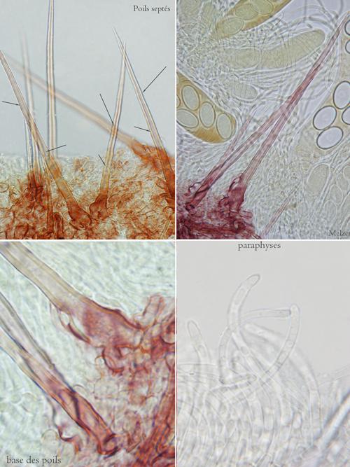 macrostoma