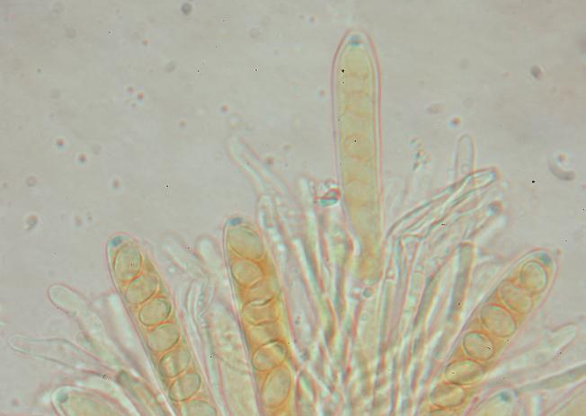 macrostoma