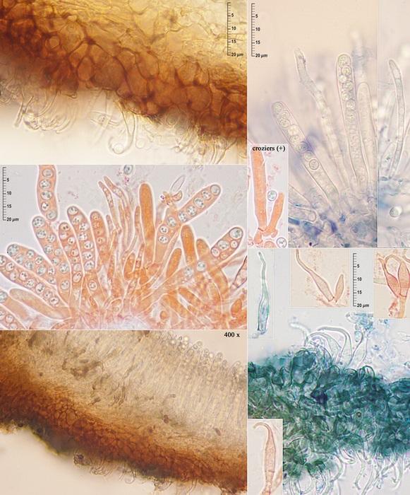 macrostoma