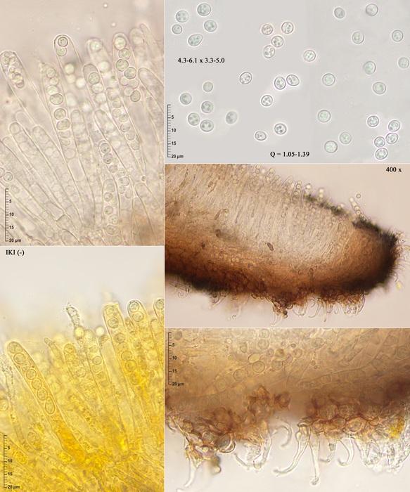 macrostoma