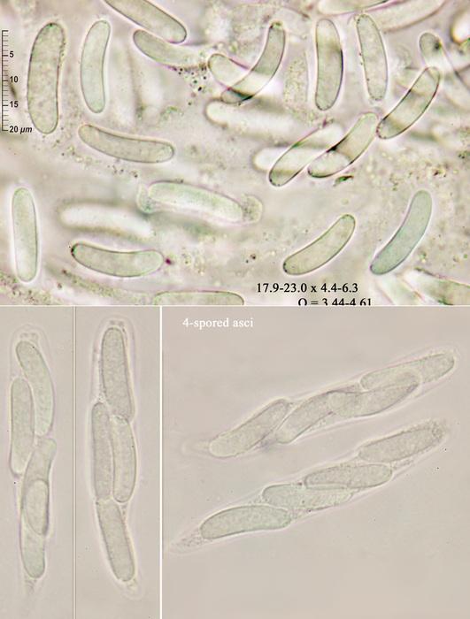 macrostoma