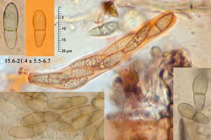 macrostoma