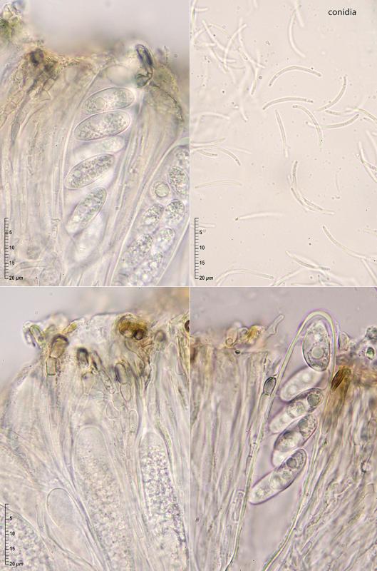 macrostoma