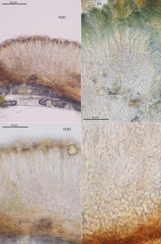 macrostoma