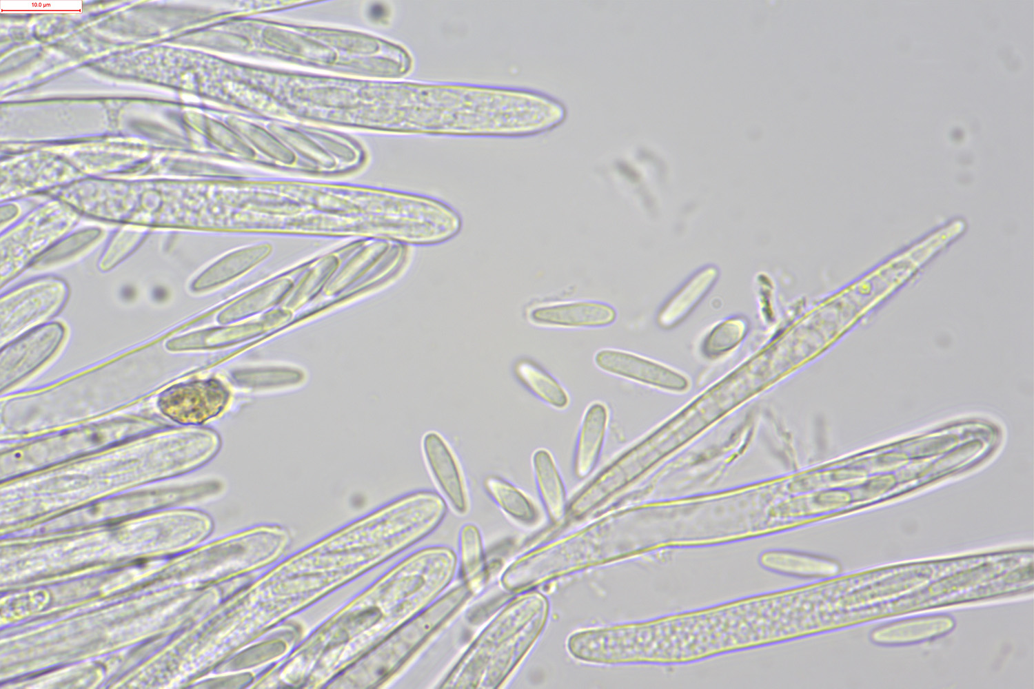 macrostoma