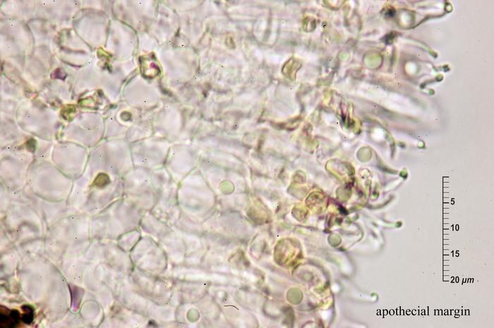 macrostoma