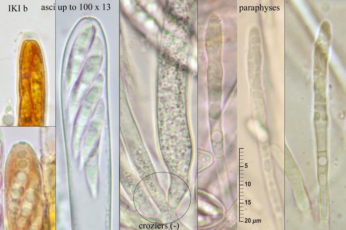 macrostoma