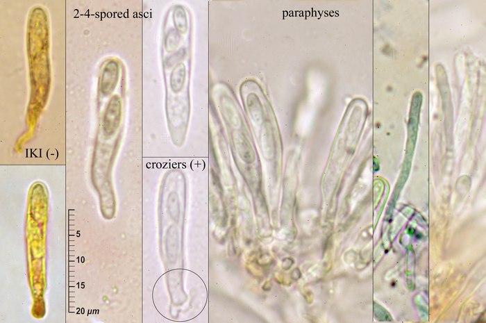 macrostoma