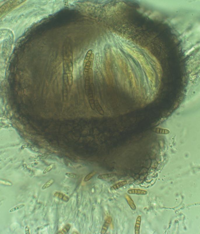 macrostoma