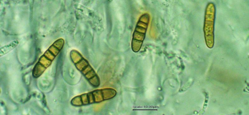 macrostoma