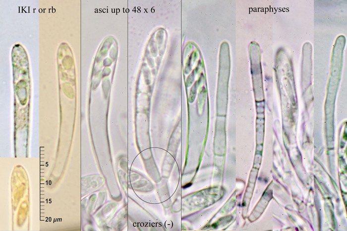macrostoma