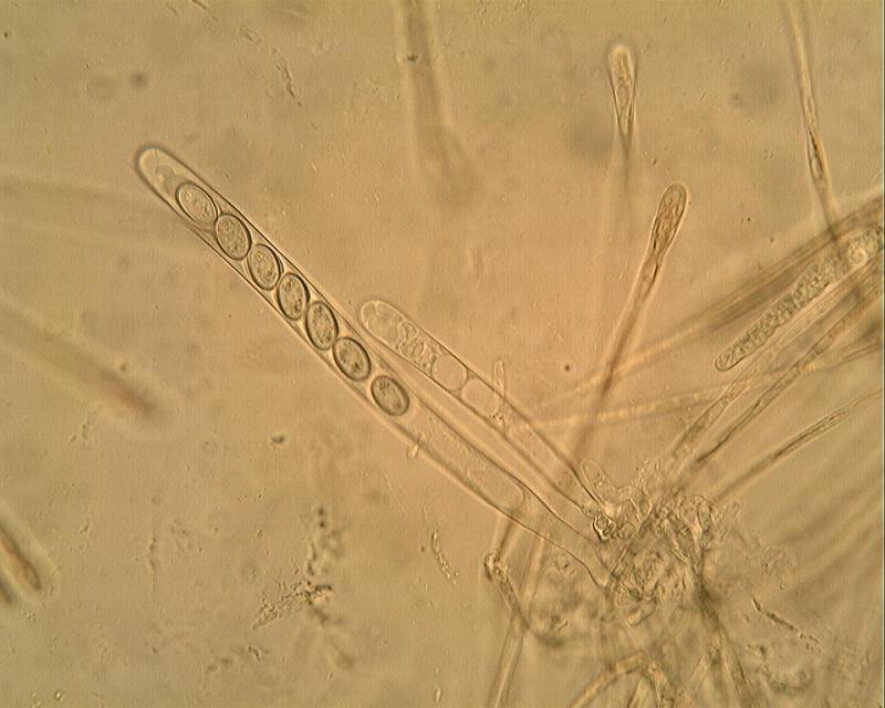 macrostoma