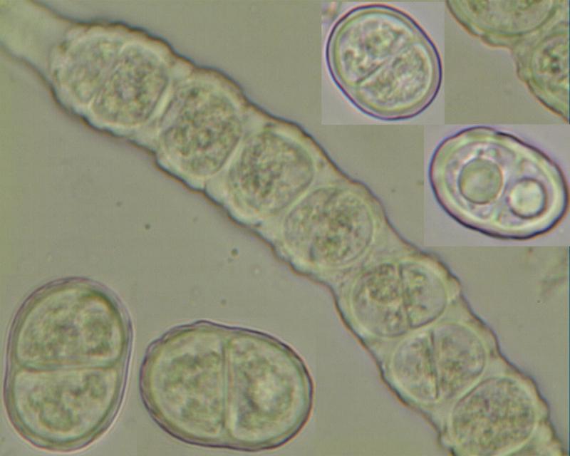 macrostoma