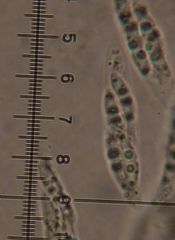 macrostoma