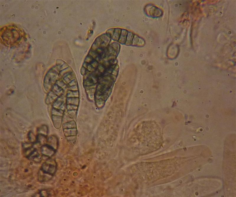 macrostoma