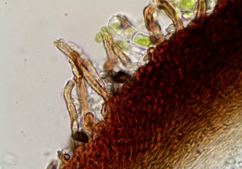 macrostoma