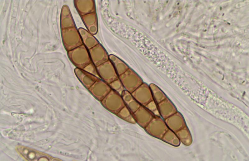 macrostoma