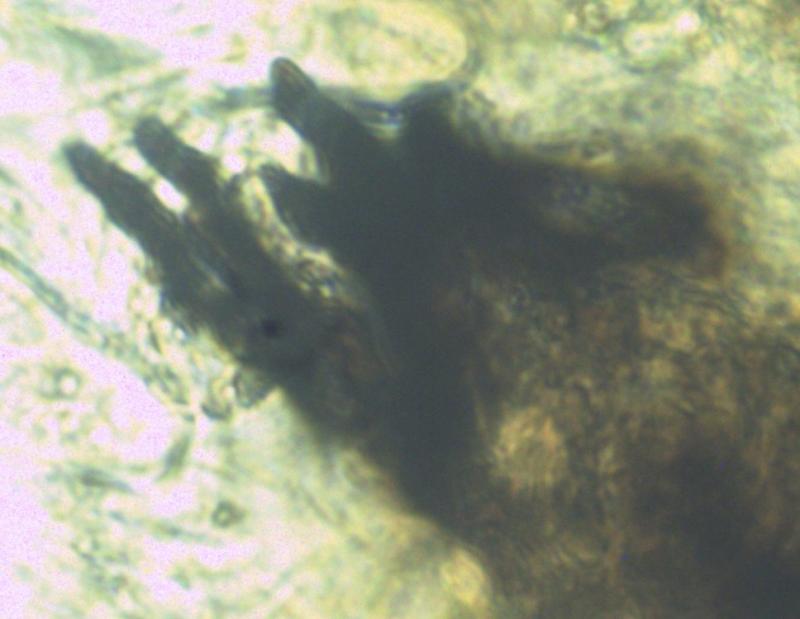 macrostoma