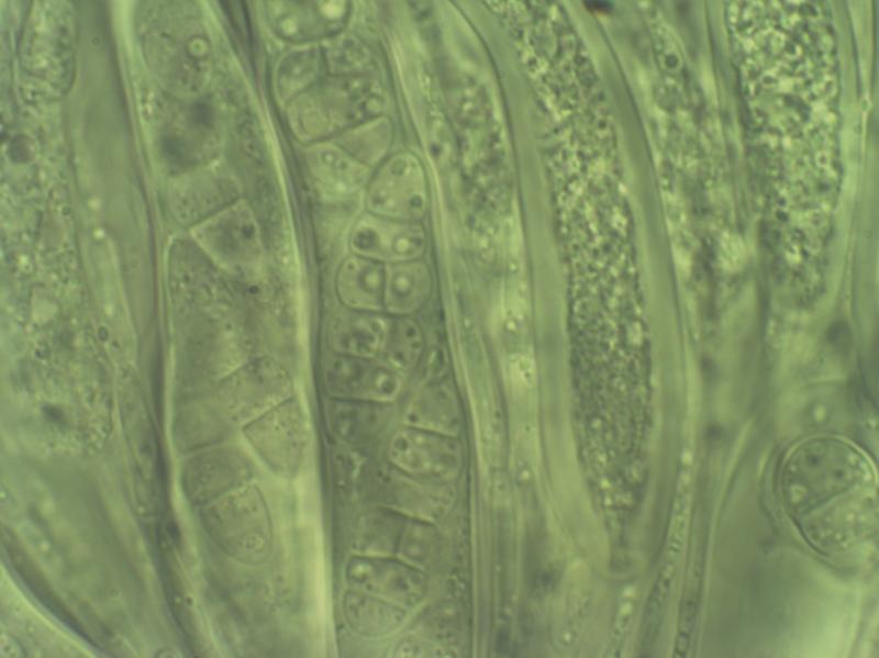 macrostoma