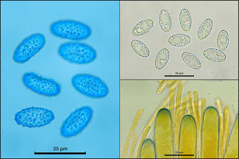 macrostoma