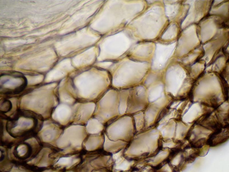 macrostoma