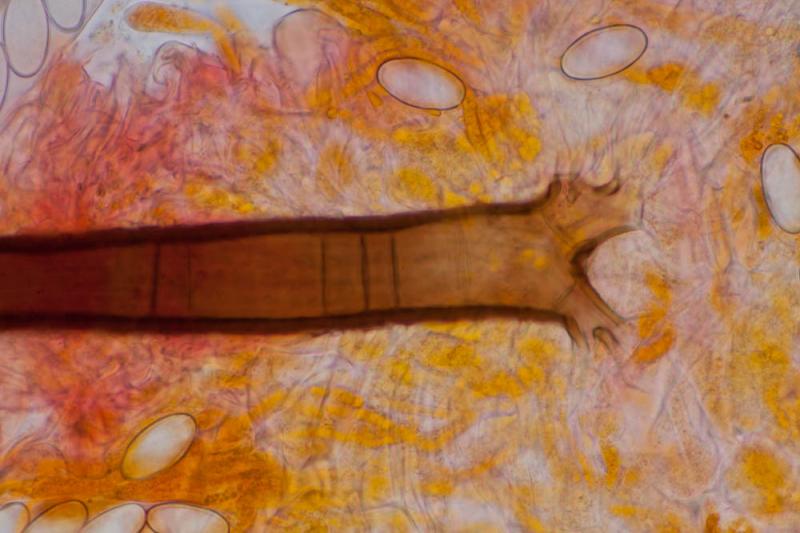 macrostoma