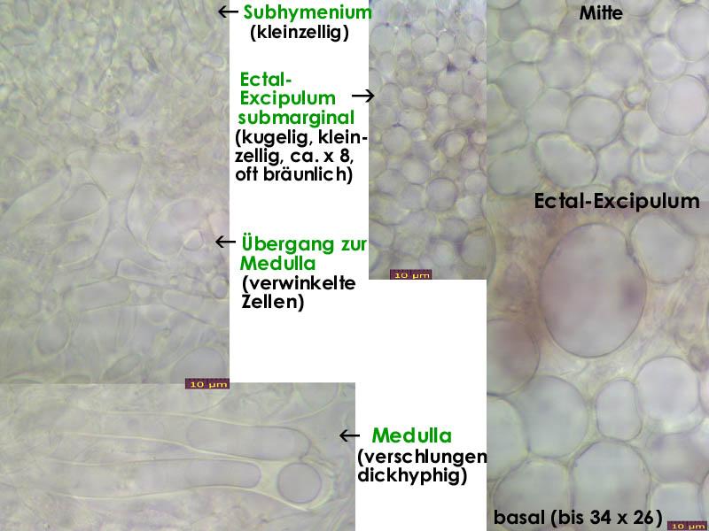 macrostoma