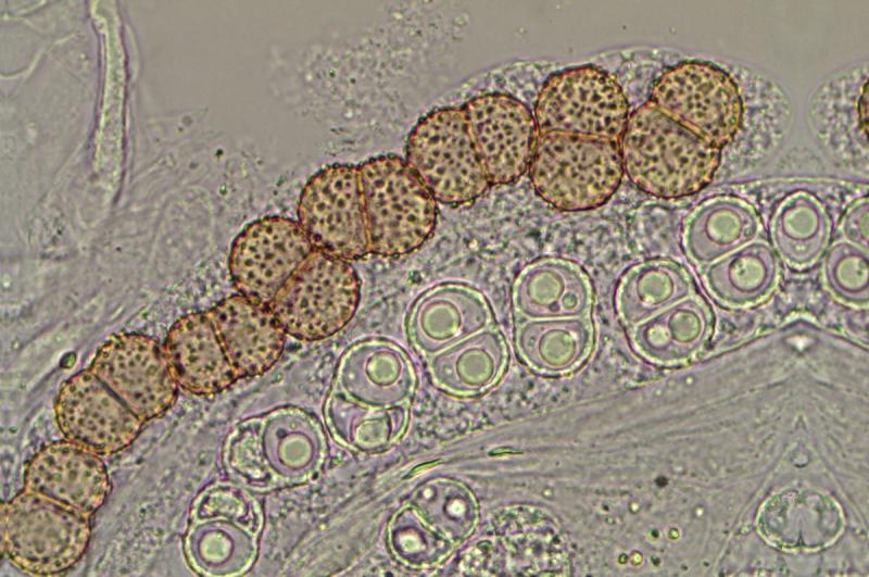 macrostoma