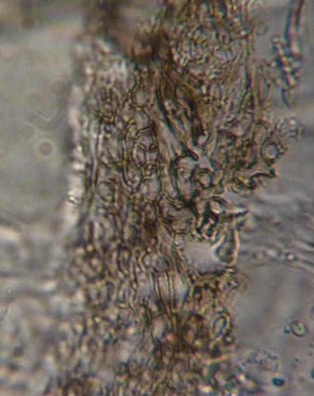 macrostoma