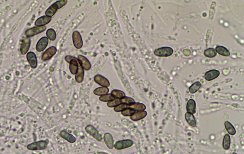 macrostoma