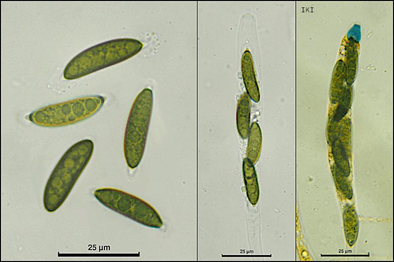 macrostoma