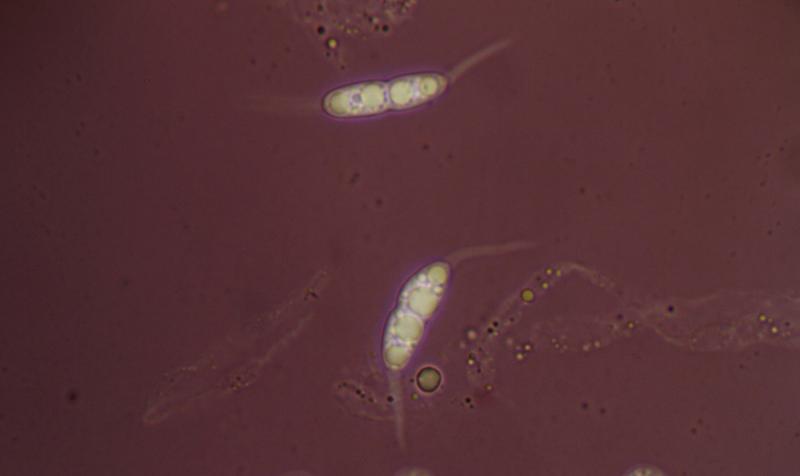 macrostoma