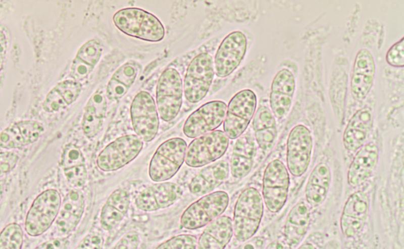 macrostoma