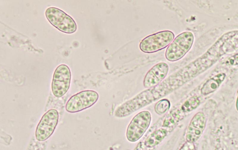 macrostoma